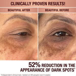 Charlotte Tilbury Dark Spot Correcting Radiance Recovery Serum 30ml